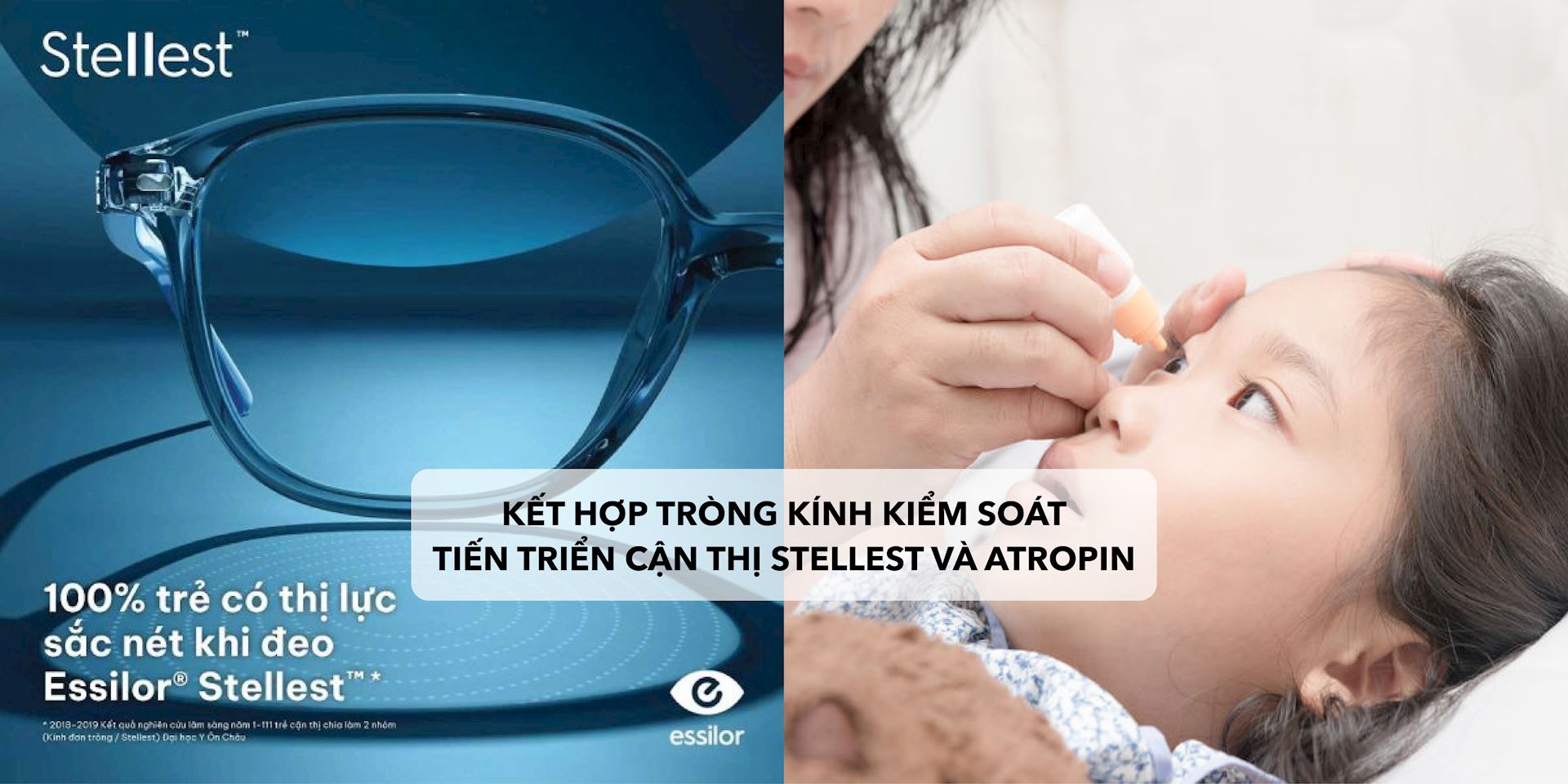 Có nên dùng đồng thời Stellest và Atropine trong kiểm soát cận thị?