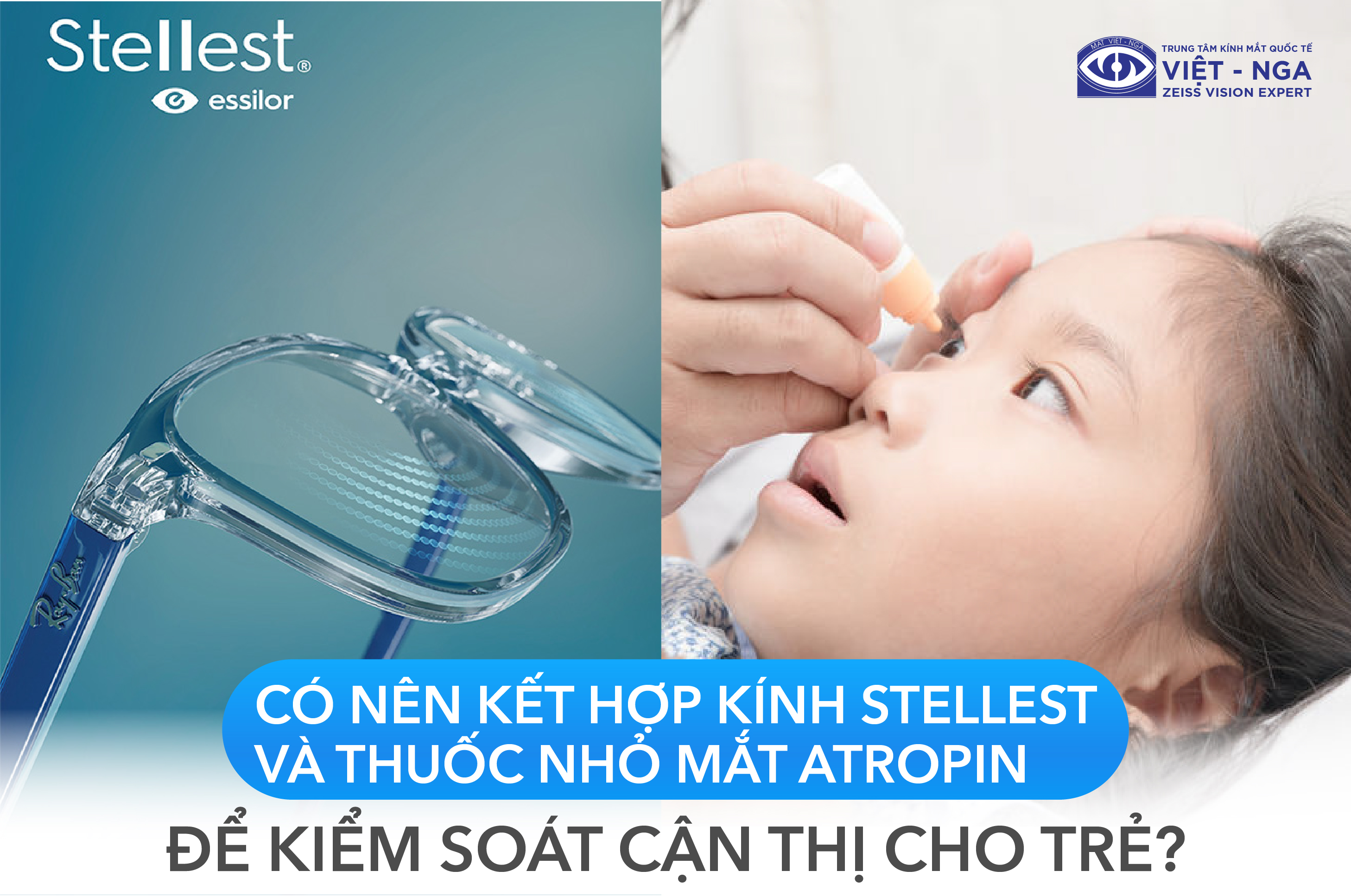 Có nên kết hợp kính Stellest và thuốc nhỏ mắt Atropin để kiểm soát cận thị cho trẻ? 